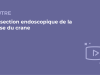 SFORL_VIEWR_video_vignettes-COMMUNAUTEORL177