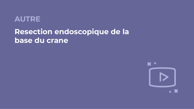 SFORL_VIEWR_video_vignettes-COMMUNAUTEORL177