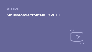 SFORL_VIEWR_video_vignettes-COMMUNAUTEORL179