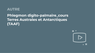 SFORL_VIEWR_video_vignettes-COMMUNAUTEORL20