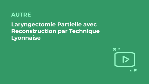 SFORL_VIEWR_video_vignettes-COMMUNAUTEORL3