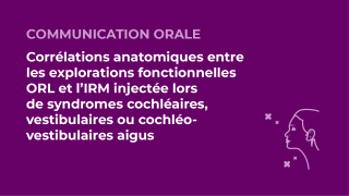 SFORL_VIEWR_video_vignettes-CONGRES_Audiologie-otologie-Oto-neurologie-vertiges26