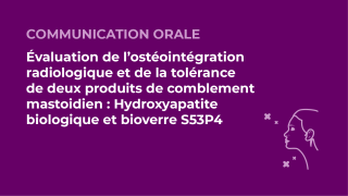 SFORL_VIEWR_video_vignettes-CONGRES_Audiologie-otologie-Oto-neurologie-vertiges43