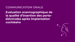 SFORL_VIEWR_video_vignettes-CONGRES_Audiologie-otologie-Oto-neurologie-vertiges47