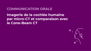 SFORL_VIEWR_video_vignettes-CONGRES_Audiologie-otologie-Oto-neurologie-vertiges58