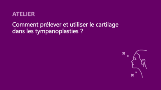 SFORL_VIEWR_video_vignettes-CONGRES_Otologie_01